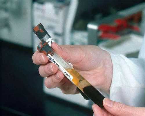 正规借卵中心及试管婴儿费用明细与花销解析