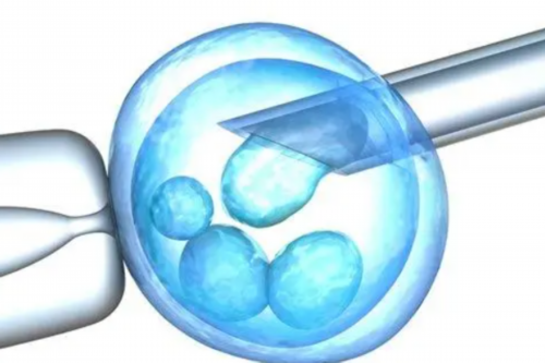 选择代孕公司与供卵费用的考量