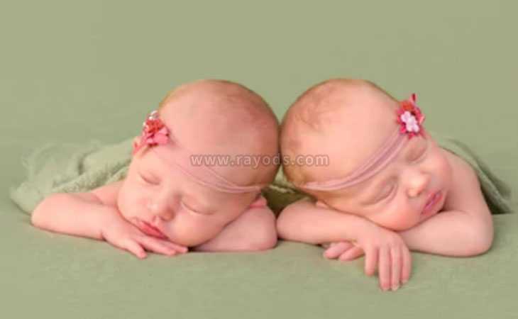 做试管婴儿双胞胎长得一样吗？